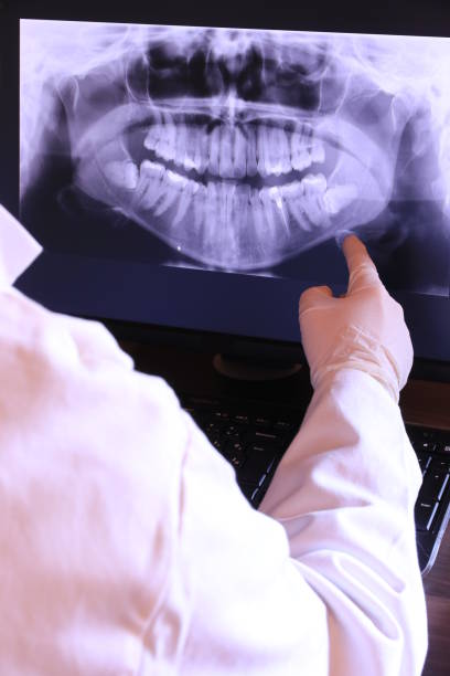 Best Chipped Tooth Repair Near Me  in Naugatuck, CT